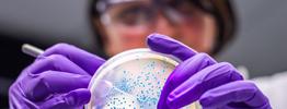 Female veterinarian performing examination of bacterial culture plate