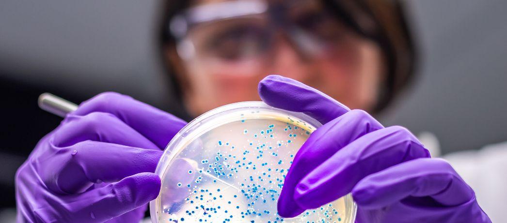 Female veterinarian performing examination of bacterial culture plate